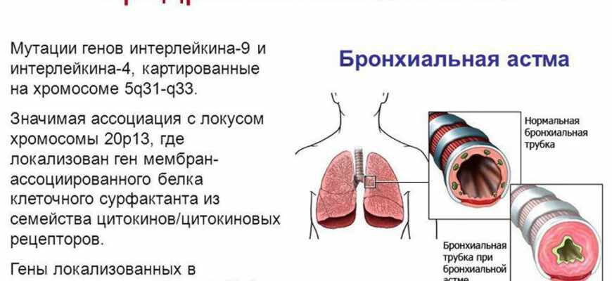 nasledstvennost pri bronhialnoj astme