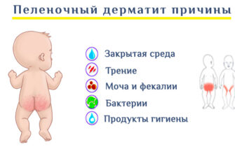 pelenochnyj dermatit u detej 1