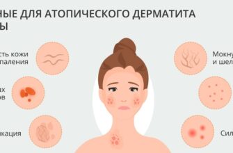simptomy i lechenie dermatita u cheloveka 1