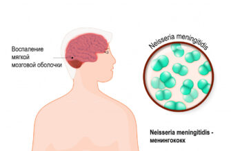 meningit 1