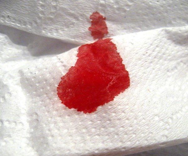 Кровотечение в акушерстве и гинекологии